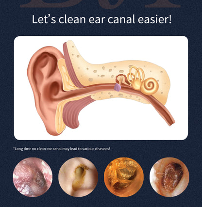 Wireless ear washer