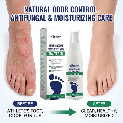 ⏳ LIMITED-TIME MEGA SALE | Getnexy™ Tea Tree Foot Spray – Natural Odor Control, Antifungal & Moisturizing Care