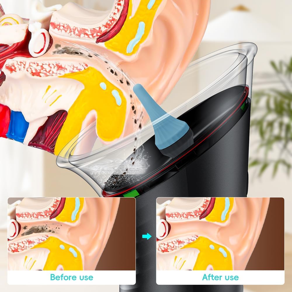 Wireless ear washer